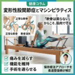 変形性股関節症に対するマシンピラティス