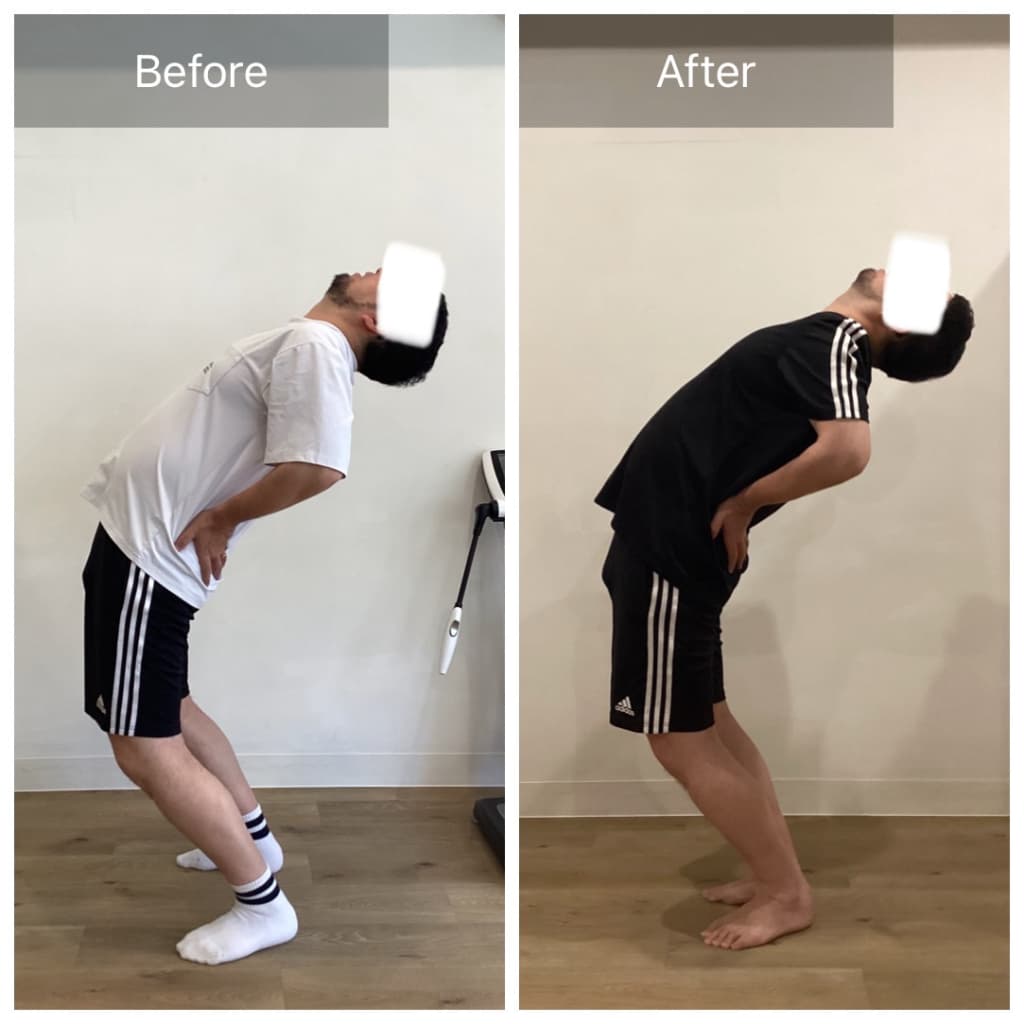 週1回×3ヵ月ピラティスを実施したビフォーアフター(後屈)